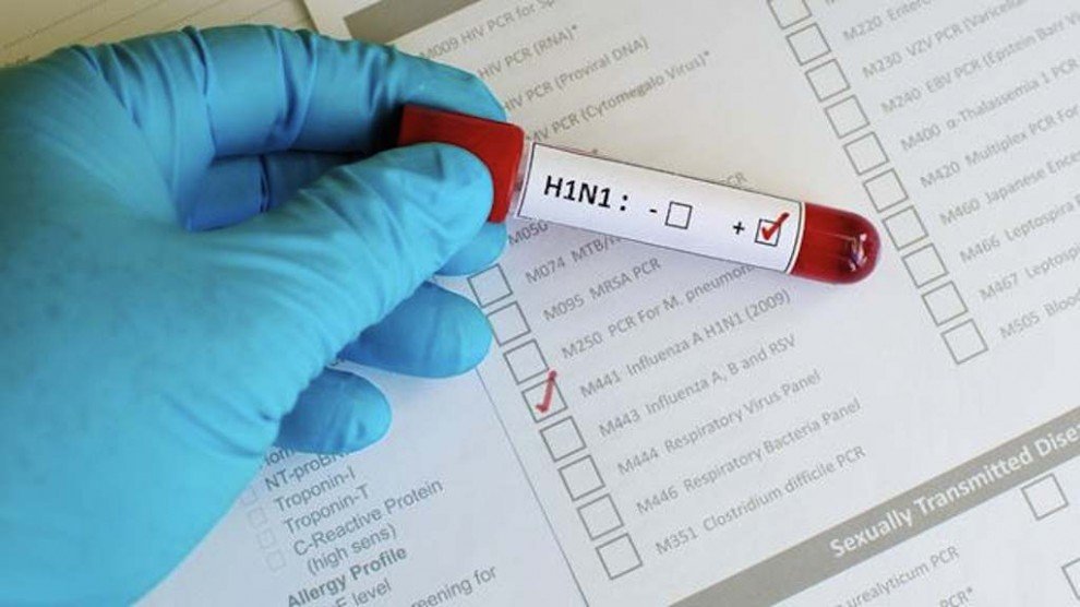 Friburgo tem pelo menos um caso confirmado de H1N1