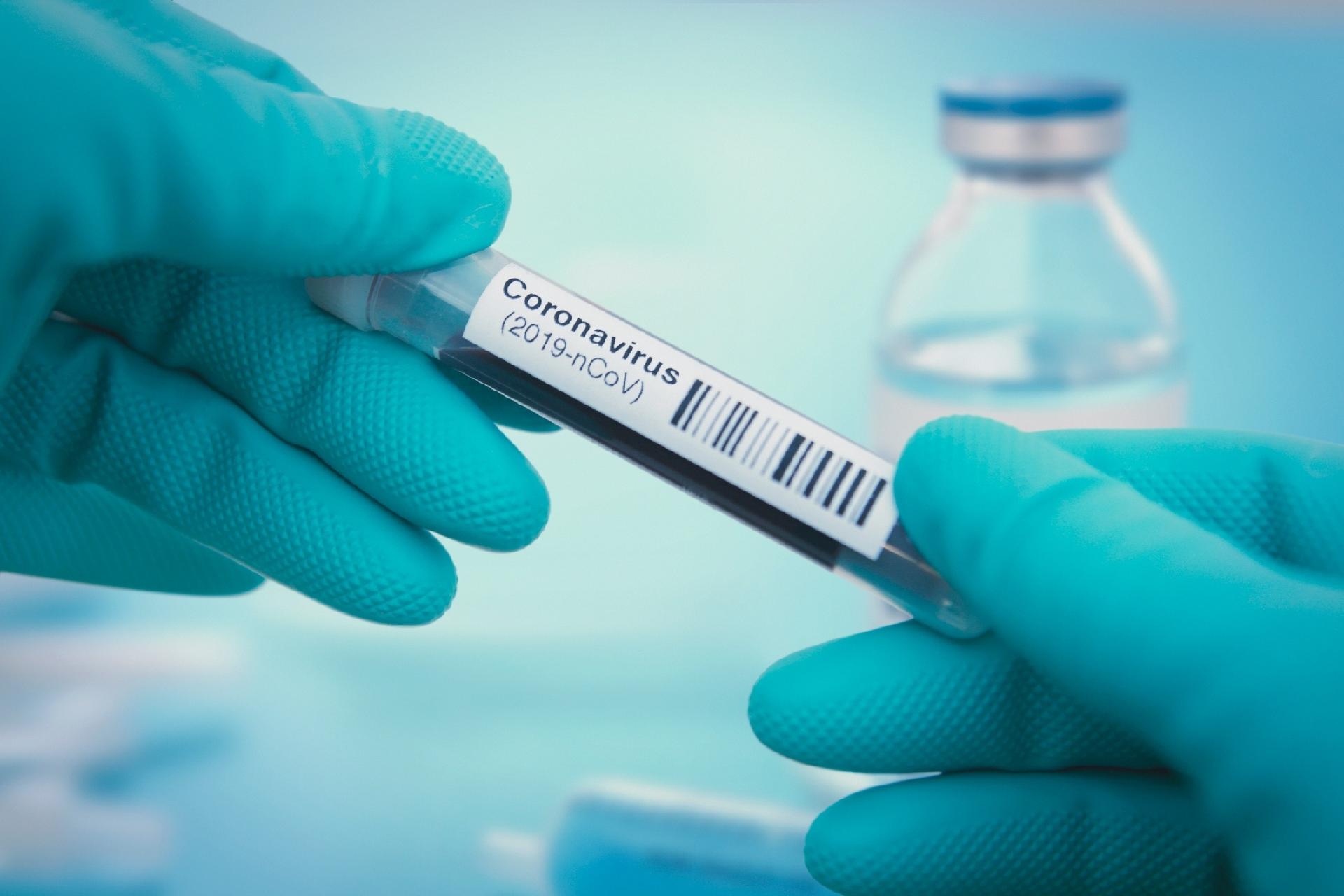 Friburgo já realizou 3.139 testes desde o início da pandemia 